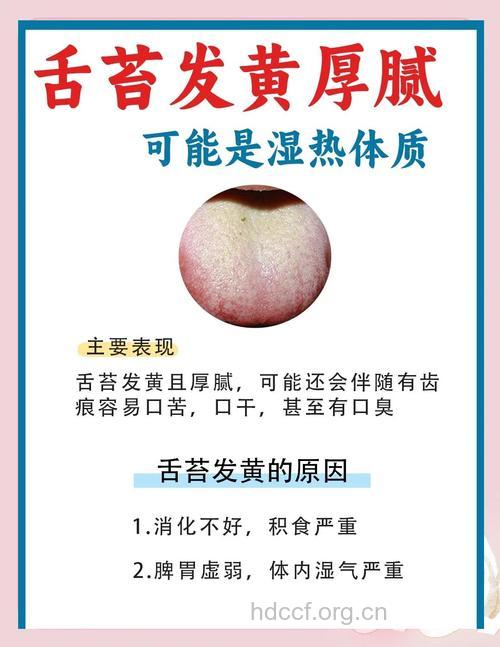 养生要警惕 出现舌苔黄腻要当心