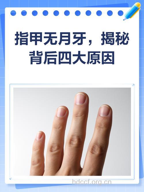 指甲没有月牙是病吗 从指甲看健康