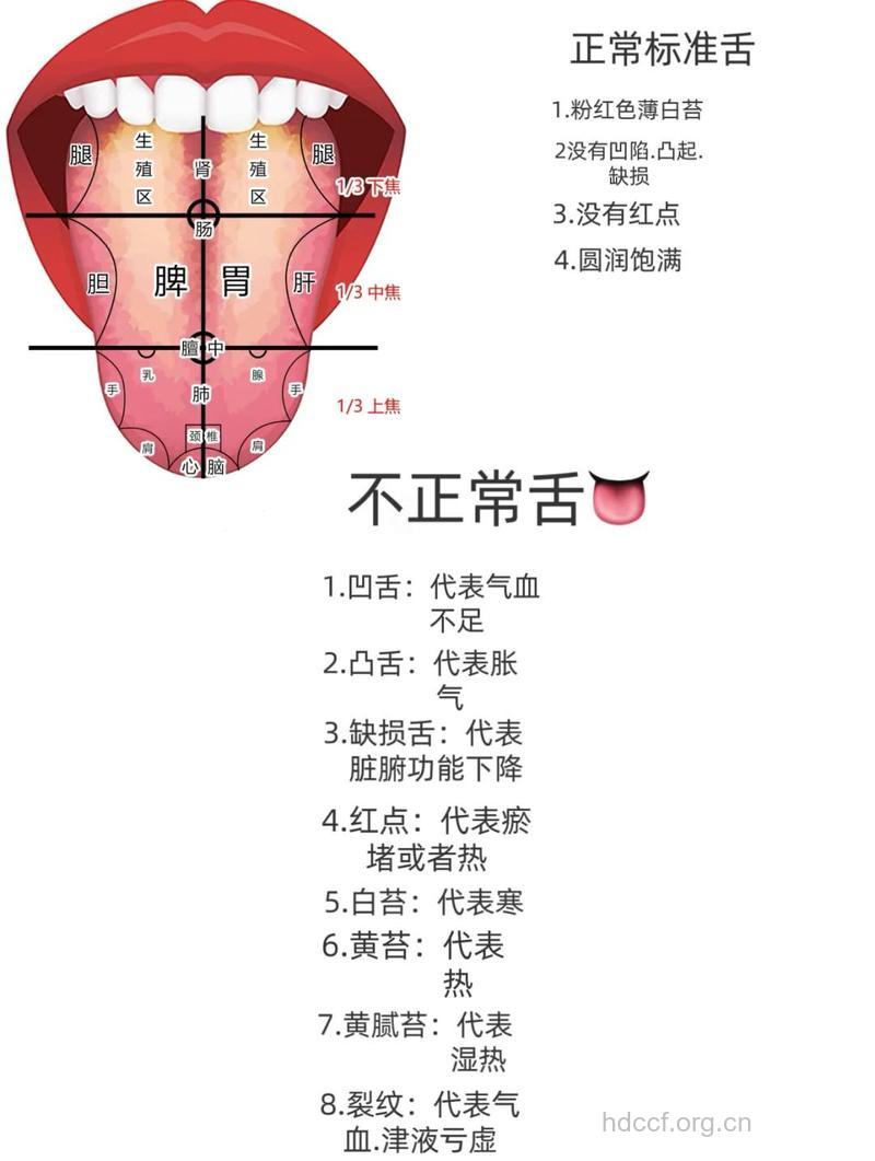 看舌头就知道健康 如何从舌头诊断疾病