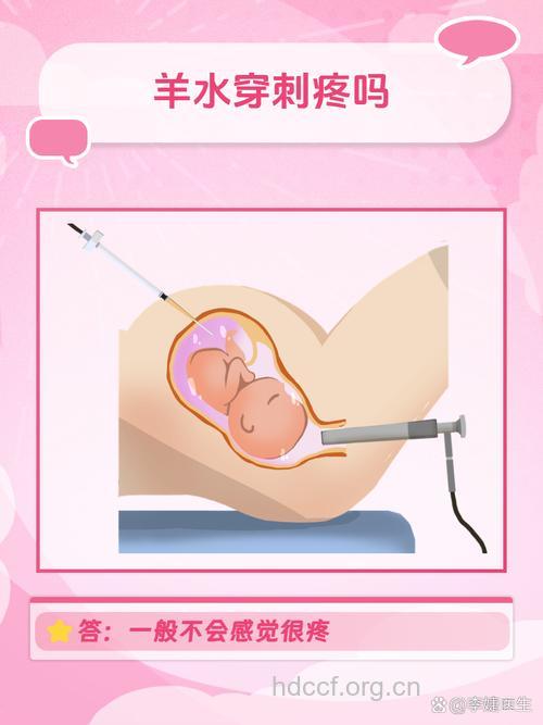 孕妇羊水穿刺会疼吗