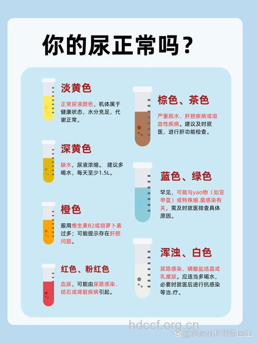 尿液颜色多达7种 教你从尿液颜色看健康