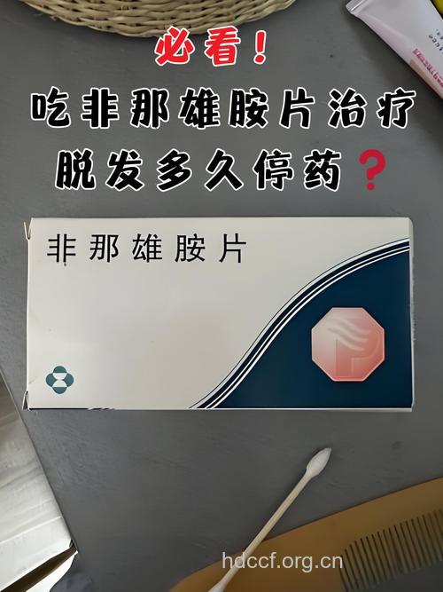 治疗脱发药物 切莫要乱吃