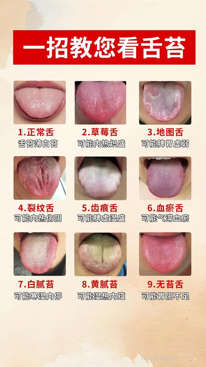 中医教你如何从看舌头判断出疾病
