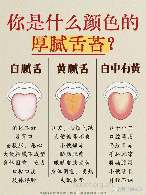 舌苔厚白是怎么回事 如何调理