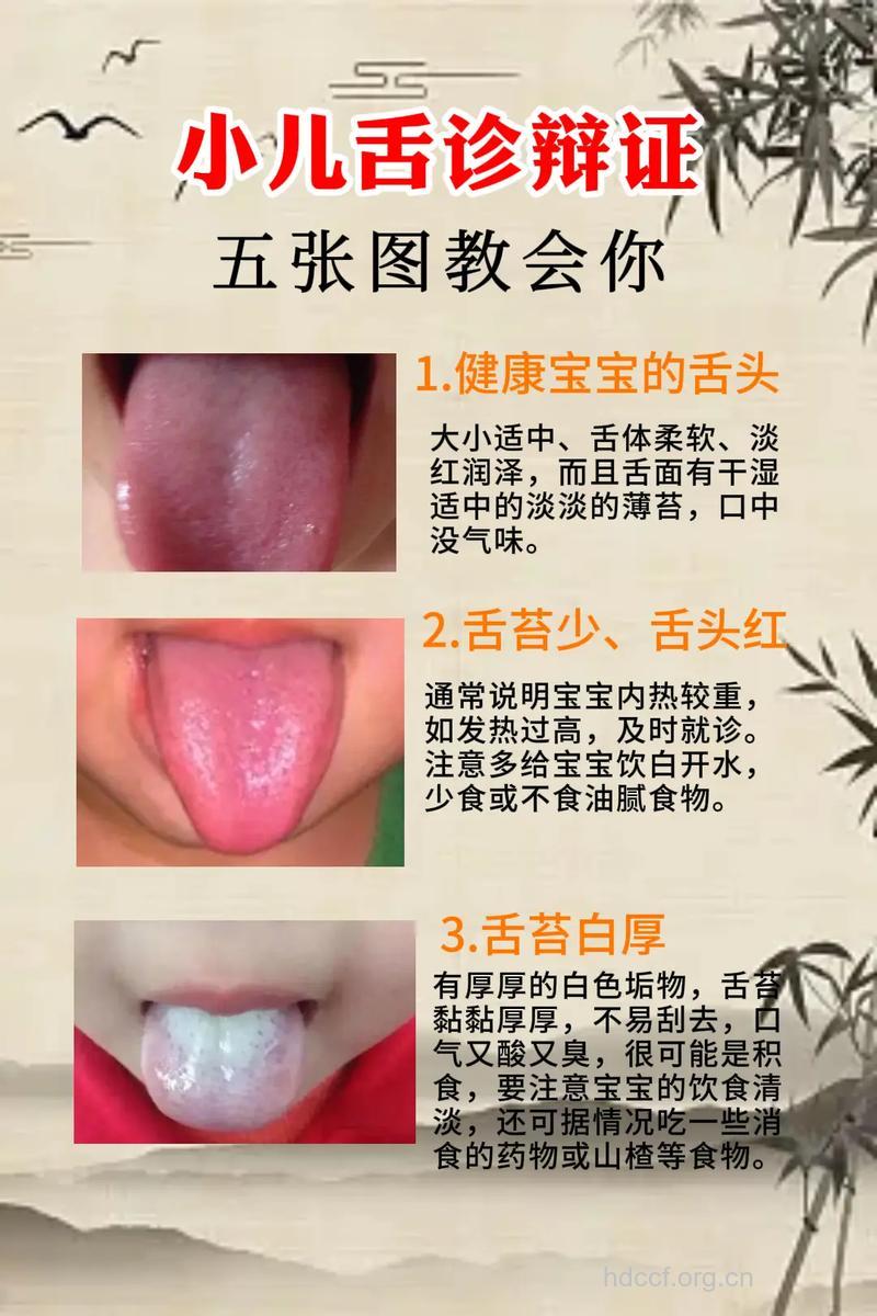 专家解读 宝宝舌苔厚白是怎么回事