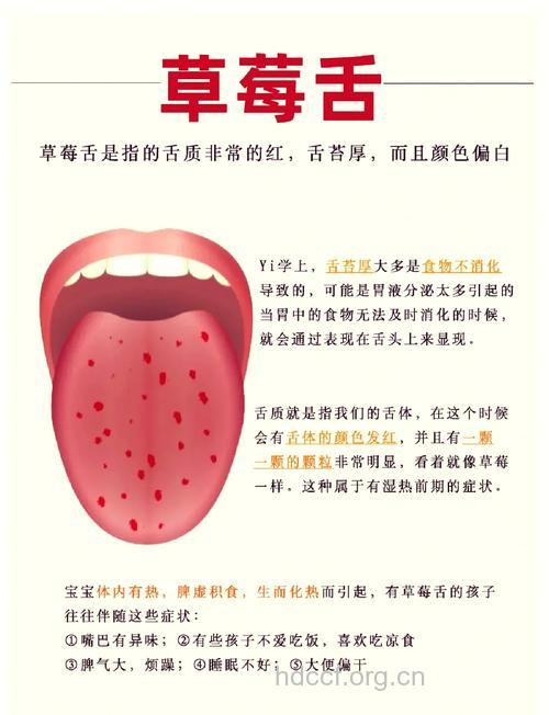 关于草莓舌 你了解多少