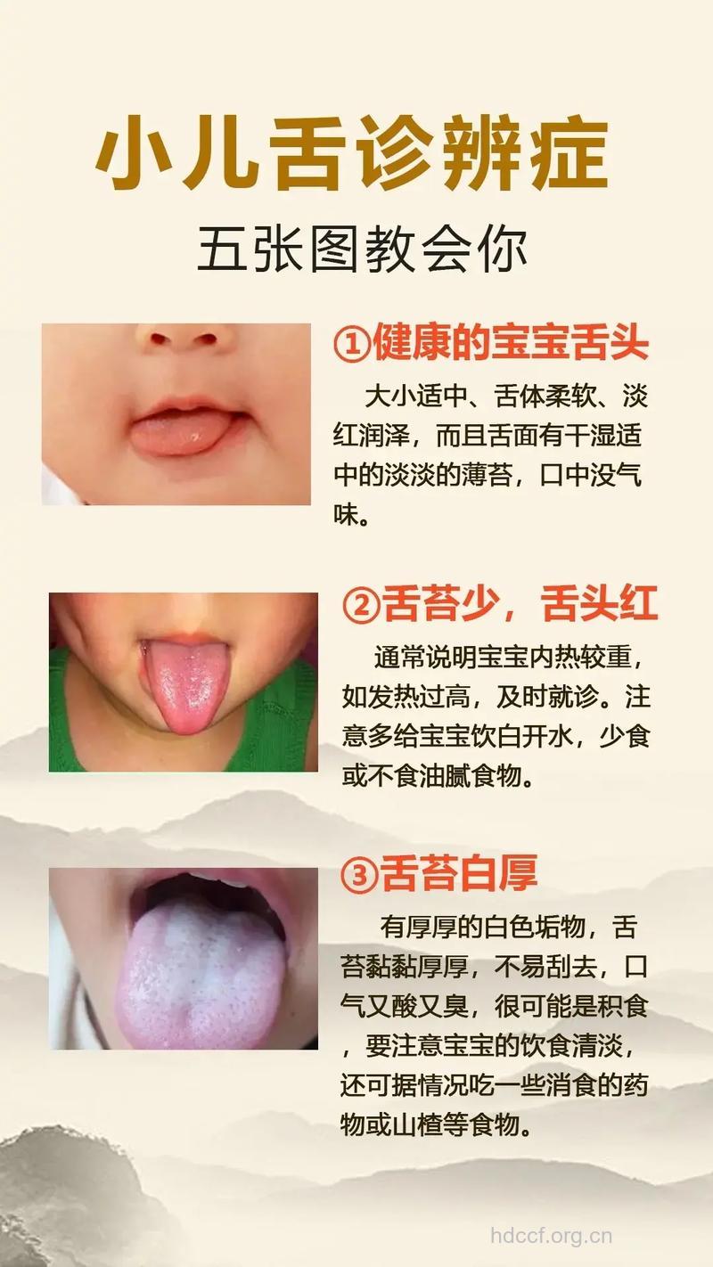 宝宝舌苔厚白 吃什么调理