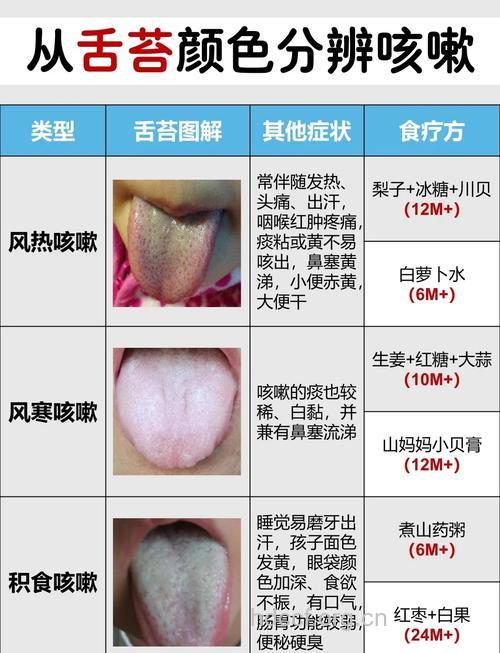 孩子舌苔厚白是怎么回事