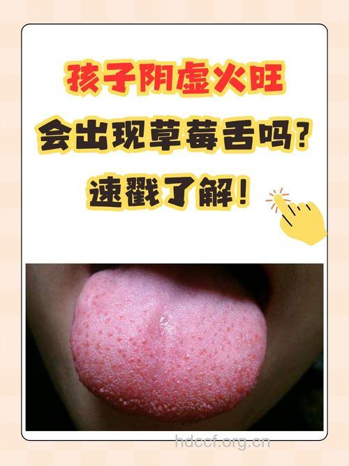 孩子有草莓舌 这正常吗
