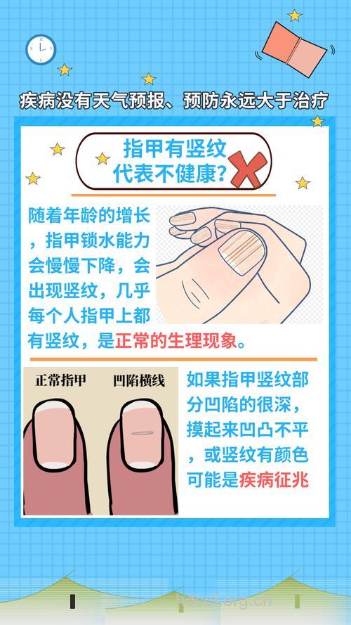 指甲看健康 指甲上有竖纹是怎么回事