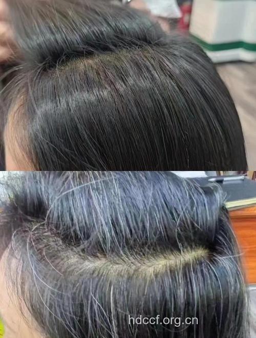 头发看健康 细软枯黄为肾气不足