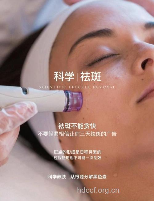 盛夏预防雀斑正当时