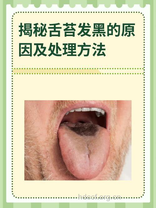 舌苔发黑四大原因及调理方法