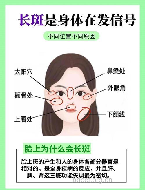 女性两颊长斑的原因是什么