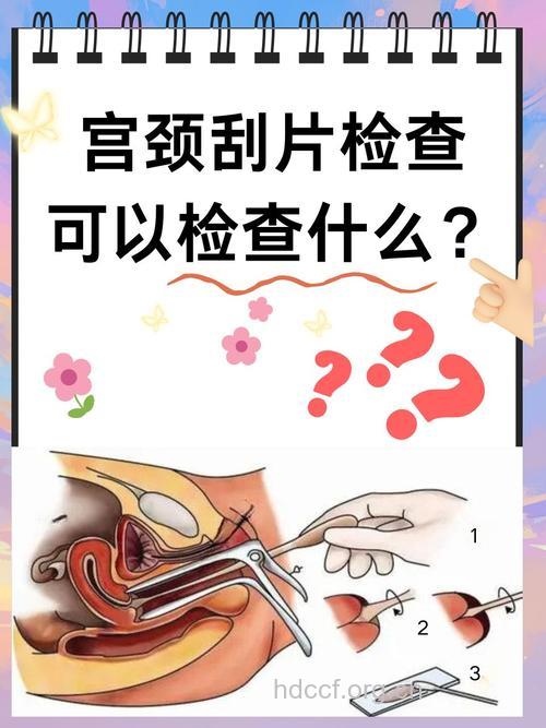 女性宫颈刮片检查都查些什么