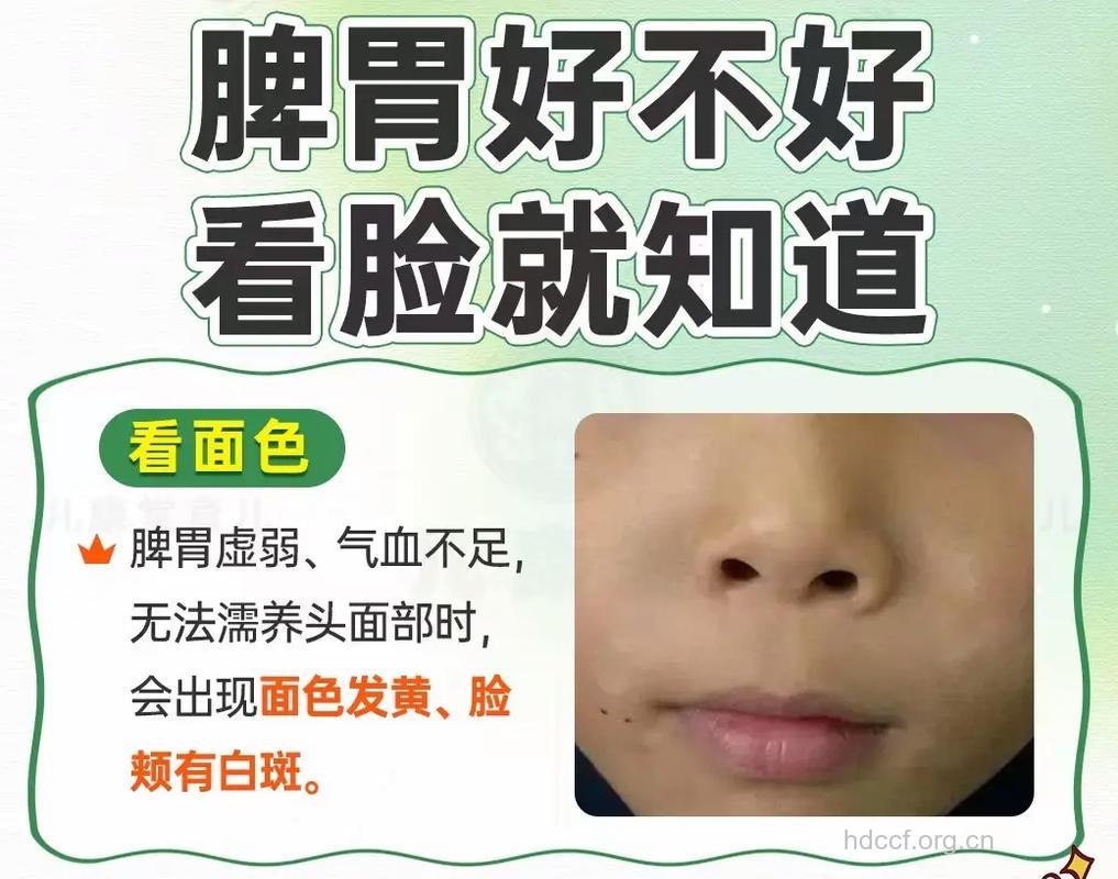 中医教你看脾胃健康 脸黄嘴边黑是脾虚