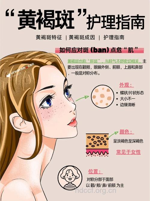 护理黄褐斑的方法有哪些