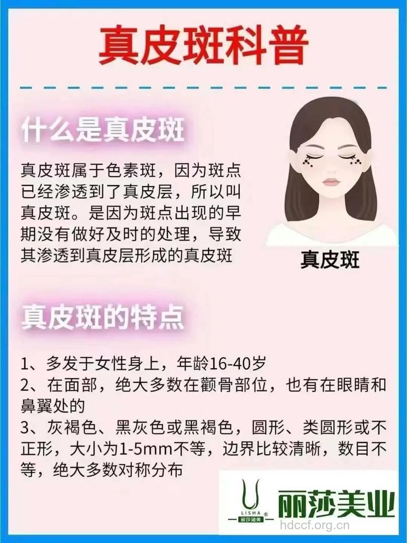 色斑的原因都有哪些呢