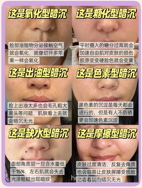 肤色越来越黯淡的原因是什么