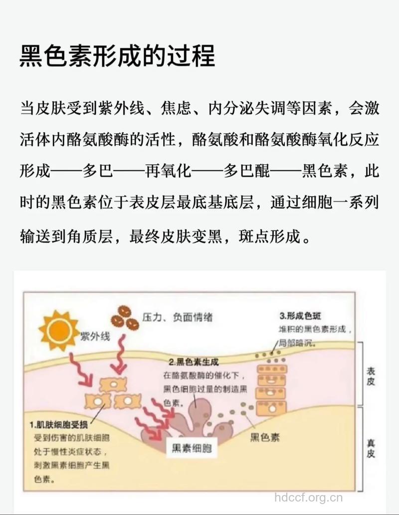 色斑的形成有哪些内在因素