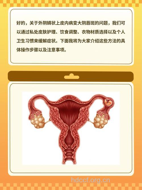 色斑形成的外因都有哪些呢