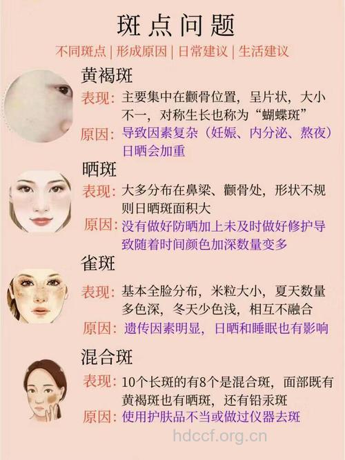 色斑有哪些分类与病因