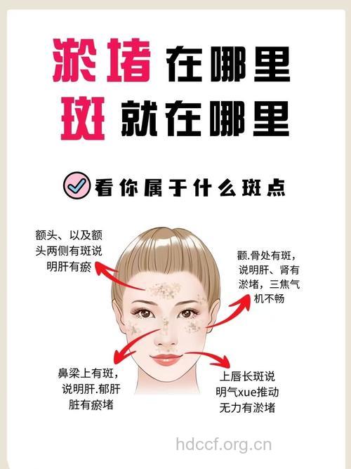 色斑会体现出哪些健康问题