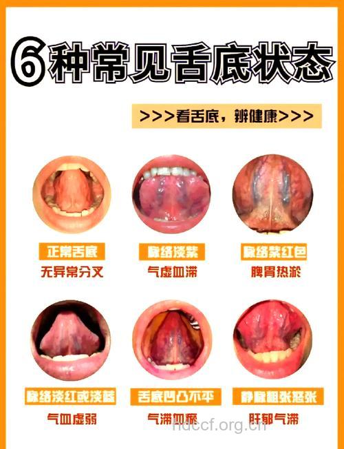 哪些原因导致舌头青紫
