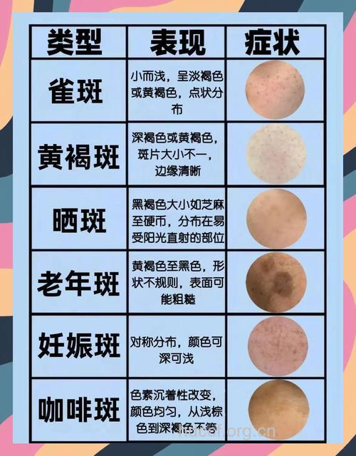 常见的“斑点”有哪些