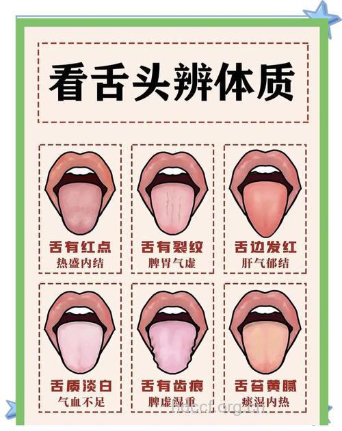 怎么从舌头判断健康状况