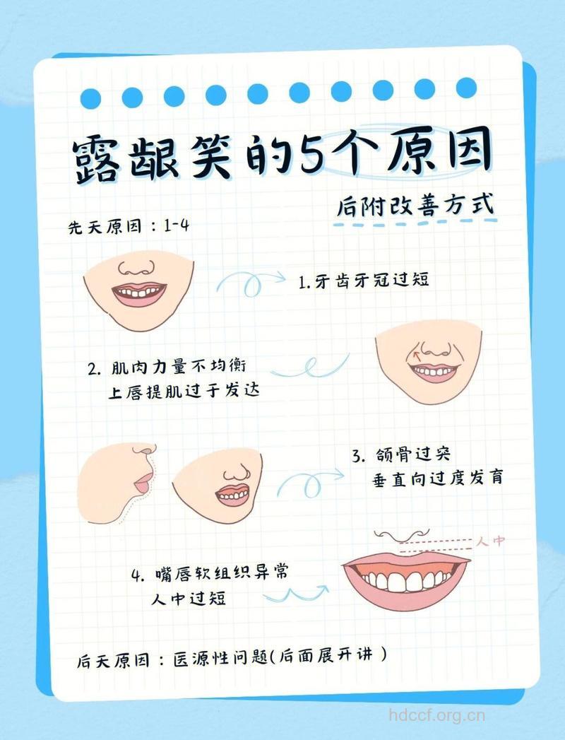 怎么从笑容判断病情