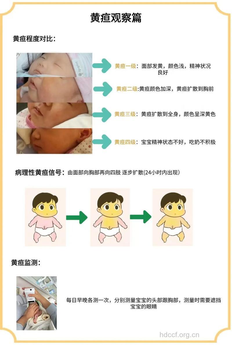 从宝宝面色怎么看出疾病