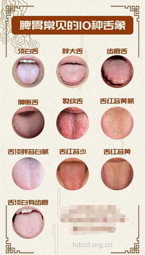 从舌苔怎么能看出胃病