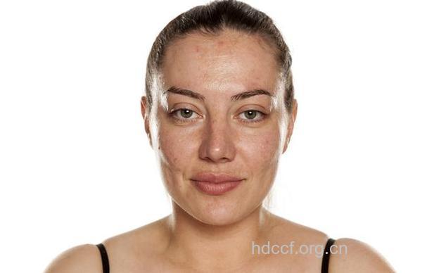 你的饮食问题肤色暴露