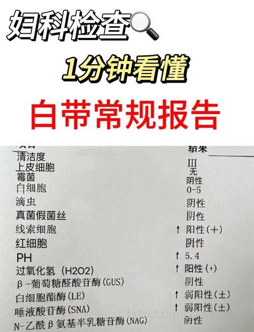 女性白带多要检查哪一些?