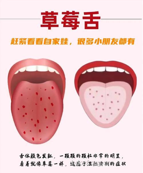 怎么去辨别口味自测疾病