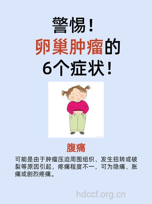女性腹部疼痛应排查卵巢癌