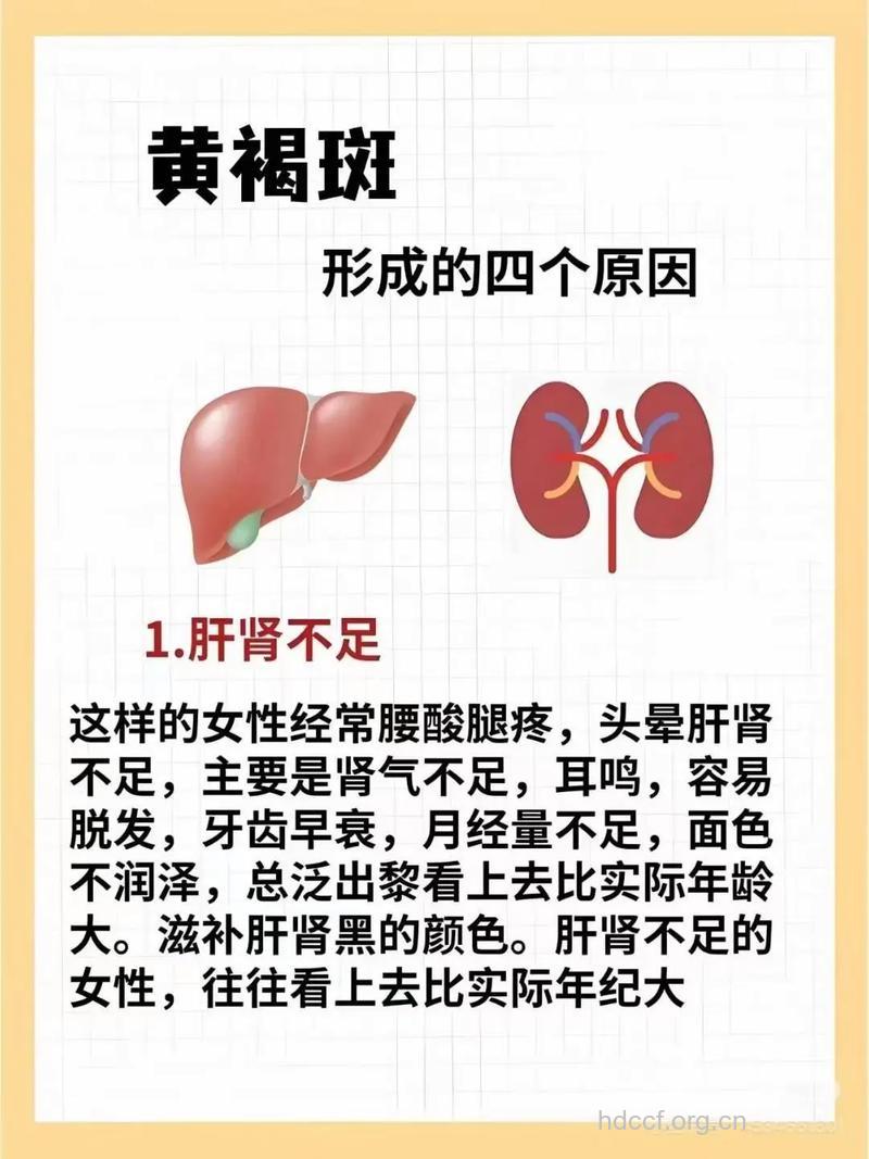 黄褐斑的形成因素是哪些
