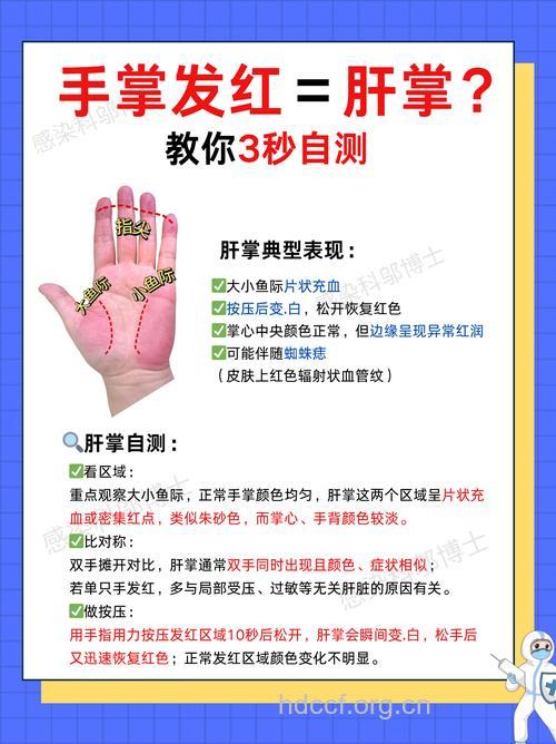 让手掌告诉你肾脏是否健康