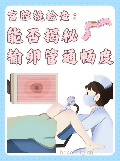 关爱女性健康 认识腹腔镜检查