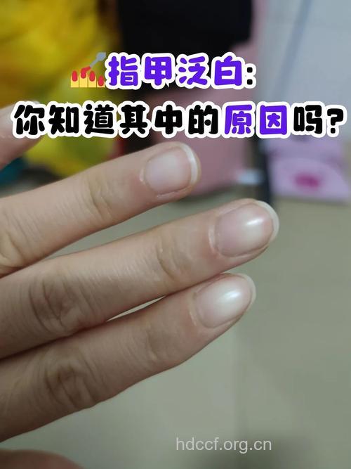 自诊：指甲发白是肾虚吗