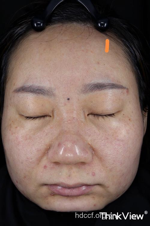 看看脸色 你得病了吗