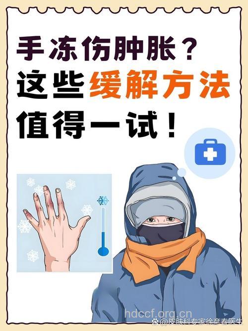 冬季手开始冻疮了怎么办?