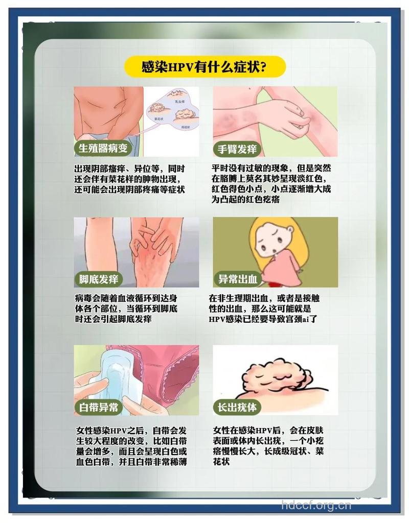 女性朋友怎么应对私处癌症方法