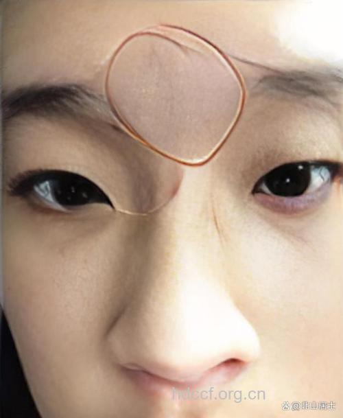 印堂发黑就一定是有厄运吗