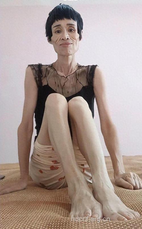 又高又瘦的女孩最易患乳腺癌