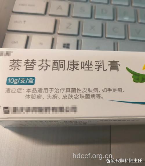 什么是花斑癣 花斑癣用什么药