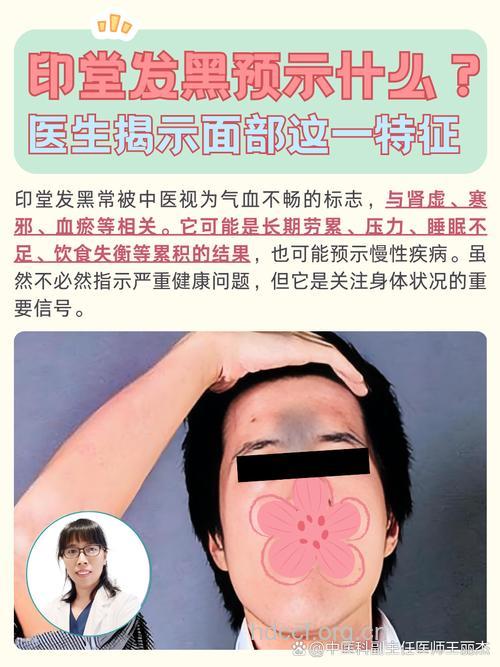 望印堂 印堂发黑就一定是中毒吗