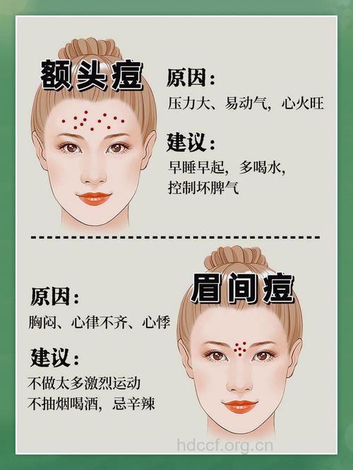 从痘痘的位置观察你的健康