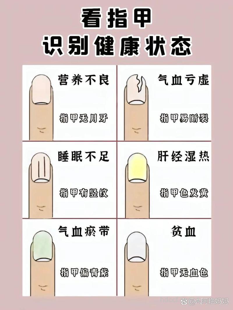 观指甲月牙 教你看自己是否健康